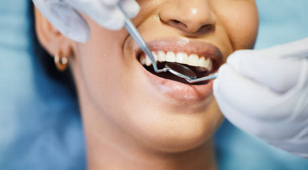 Best Emergency Dental Care for Broken or Chipped Teeth in Cicero, IL